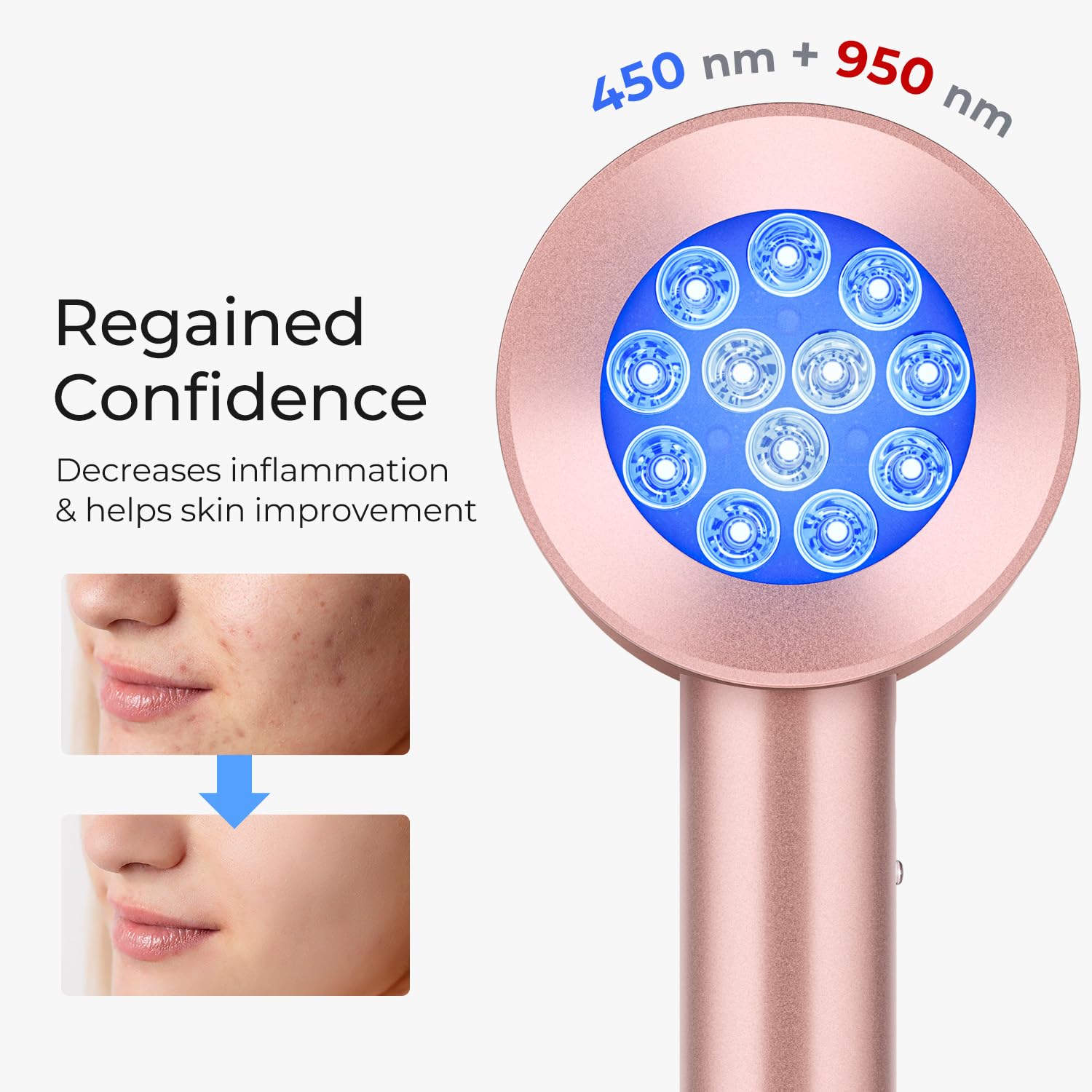 Galvanic Skin Sensor - Skin Care Red Light Therapy Anti